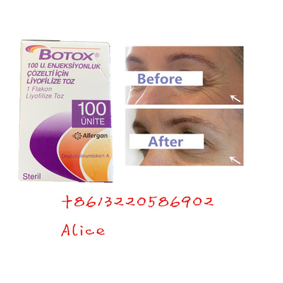 Het Type van Allergan van de anti het Verouderen Antirimpel Botulinum Toxine A Botox Poeder