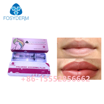 Huid de Vuller Hyaluronic Zuur van 2ml Fosyderm voor Lippenverhoging