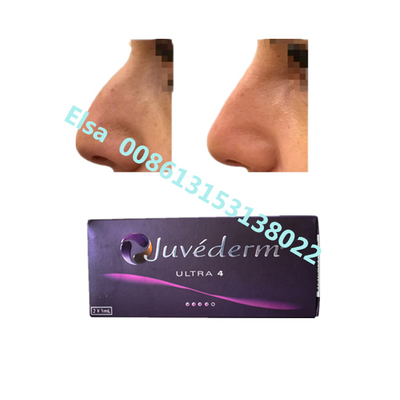 Juvederm Sodium Ultra4 Voluma Dermal Filler voor Lip Chin Augmentatie