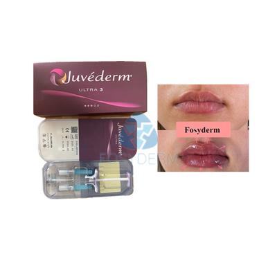 Voluma hyaluronzuur huidvuller Fosyderm voor lipverbetering