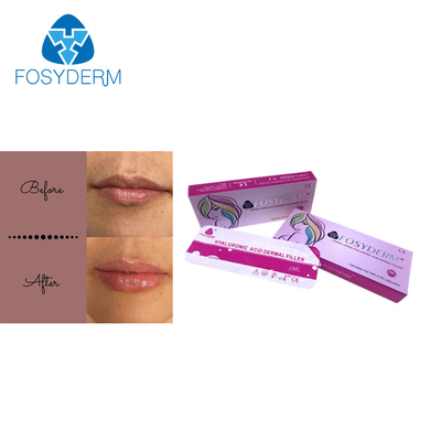 Hyaluronic Zure Huidvuller van Injectiefosyderm voor Verbonden Lippen2ml Dwars