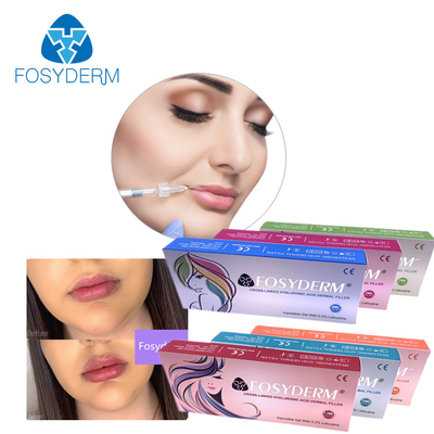 Hyaluronzuur injecteerbare huidvuller 1 ml 2 ml voor lippenvergroting