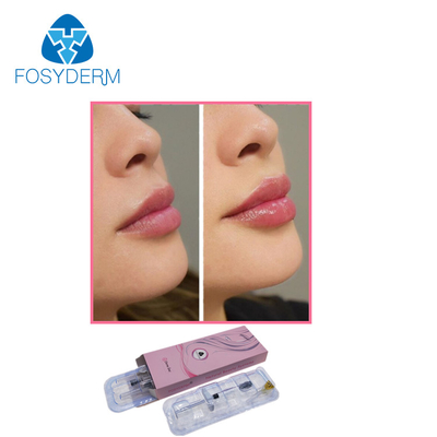 Hyaluronic Zure de Injectie Huidvuller van de Fosydermesthetica 1ml voor Lippenverhoging