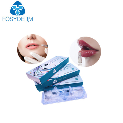 1ml hyaluronic zure Injectie van de de Lippenverhoging van Derm van lippenvullers voor Vrouwen