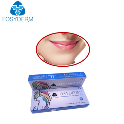 Fosyderm Hyaluronic Zure Huidvuller voor Lippenvolheid de Diepe Lijn van 2 Ml
