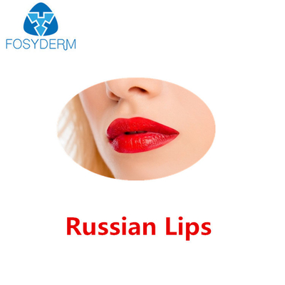 Juvederm ultra 3 Hyaluronic Zure Huidvuller Russische Lippen met Lidocaine