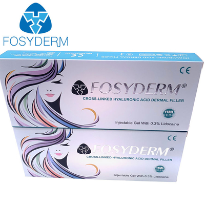 Het vullen van de Lippenvullers 1ml van Fosyderm Fosyderm van de Gezichtsinjectie Hyaluronic Zure