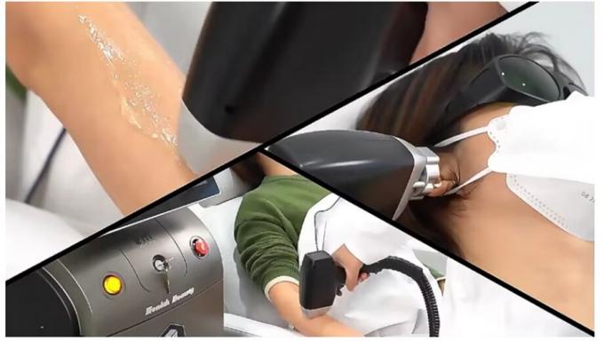 Krachtige nieuwe 808nm Ice Diode Trio 3 Wave Diode Laser 810nm Depilatie 808 Nm Haarverwijdering 3 Waves Titanium Medical Machi 2