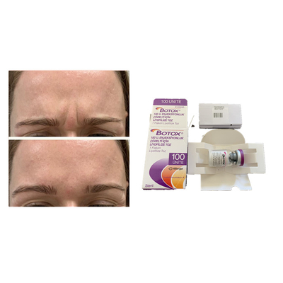 Witte de Toxine van Allergan Botulinum Anti het Verouderen  Injectie