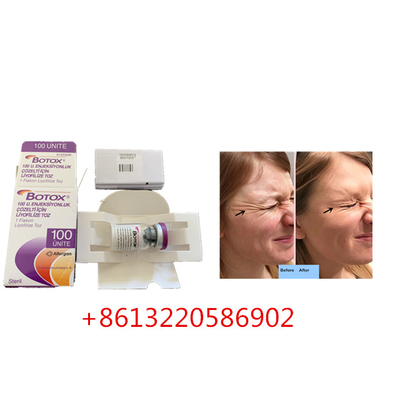 Anti het Verouderen Allergan  Injectie100units Type A Antirimpel