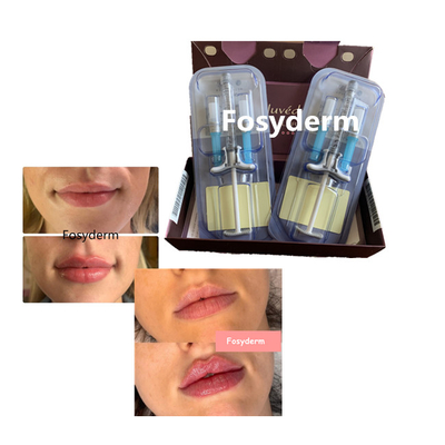 Hyaluronic Zure de Lippenvuller Kruis Verbonden 24mg van Juvedermvolbella