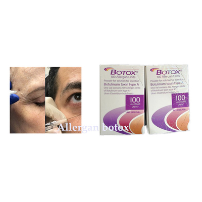 Botulinum Injectie van Toxineallergan  voor Rimpel verwijdert