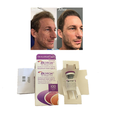 Allergan  100 eenheden Soorten Botulinetoxine-injectie Anti-rimpels