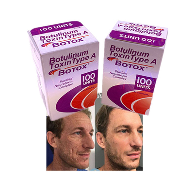 Injectie Poeder Allergan Cosmetics Anti Aging Rimpel 100 Eenheden