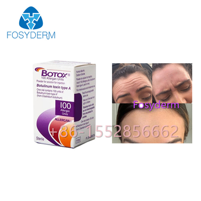 Allergan Botox 100 Eenheden Botulinum het Type van Toxine Antirimpels A Injectie