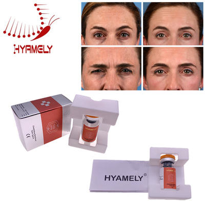 Van de Materialenhyamely  van Korea Botulinum de Toxineinjectie voor Gezichtsrimpels