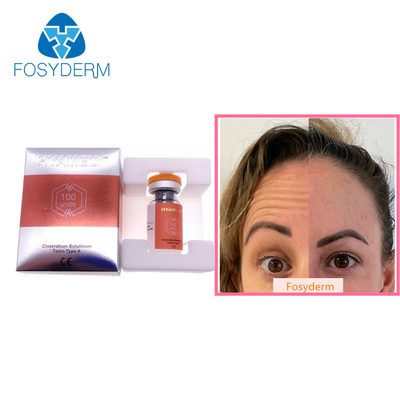 100 Eenheden Type A Botulinum van de Rimpels Botulax van Toxineallergan Anti Gezichtsinjectie