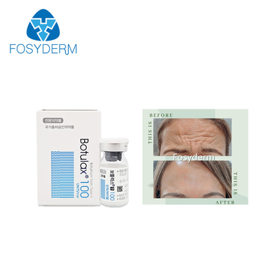 100 Eenheden Type A Botulinum van de Rimpels Botulax van Toxineallergan Anti Gezichtsinjectie