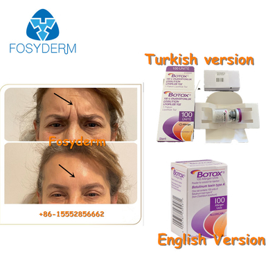 100Units Botulinum Antiinjectie TypeA  van Allergan van de Rimpeltoxine