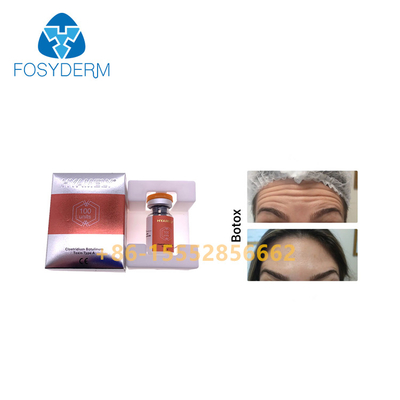 van de de Toxineinjectie van 100units TypeA Botulinum Antirimpels  Allergan
