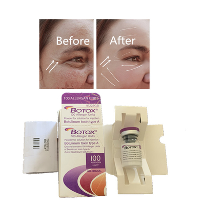 Botulinum de Toxineinjectie van Allergan voor Antirimpels het Anti Verouderen