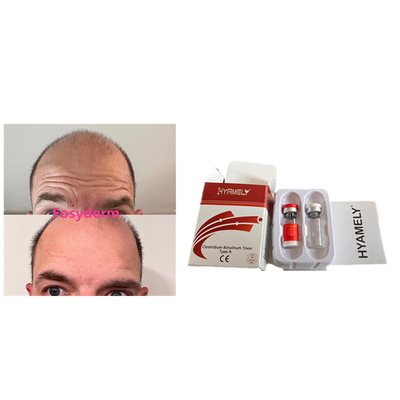 Hyamely 100 eenheden Botulinum Toxin Anti Rimpels Nieuw Product  Injectie