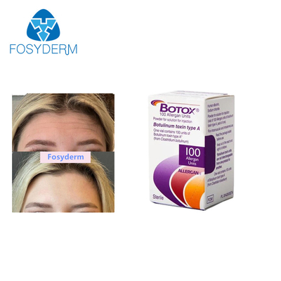 Verwijder rimpels Injectie Allergan Botulinum Toxin  Type A 100eenheden