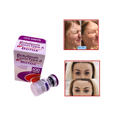 Allergan Botulinum Toxin  100 eenheden Verwijder rimpels Injectie