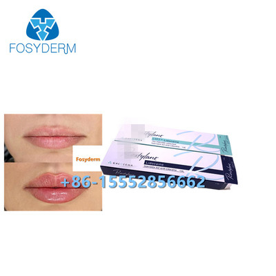 1 ml hyaluronzuur huidvuller Anti-rimpels Lipvergroting