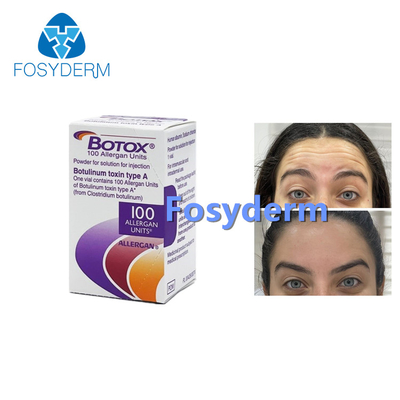 100 eenheden Botulinum Toxin Allergan Anti Wrinkles Injectie  Type A