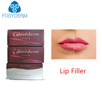 Juvederm Hyaluronzuur Dermale Filler Anti Aging Face Lip Filler 24 mg
