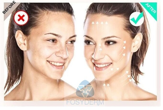 Gevuld  135 HA Mesotherapie Serum FILORGA 5*3 ml Huid Booster Verjonging