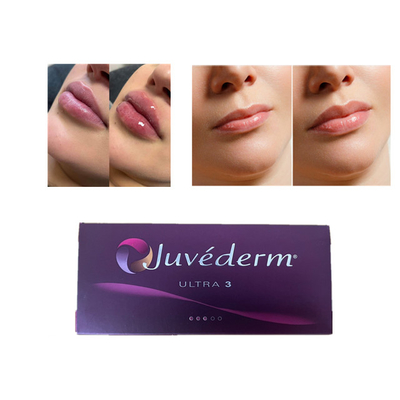 Juvederm Hyaluronzuur huidvuller Anti-rimpels Gezichtslipvuller