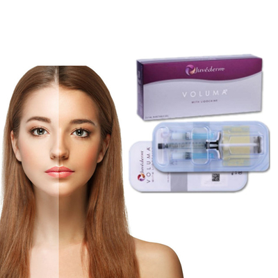 Juvederm Hyaluronzuur huidvuller Anti-rimpels Gezichtslipvuller