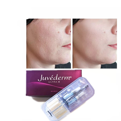 Juvederm Hyaluronzuur huidvuller Anti-Aging 2*1ml gezichtsvuller