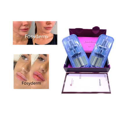 Juvederm Hyaluronzuur huidvuller Anti-Aging 2*1ml gezichtsvuller