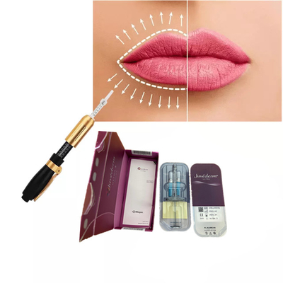 Juvederm Hyaluronzuur huidvuller 2 ml Lipvergroting Gezichtsvuller