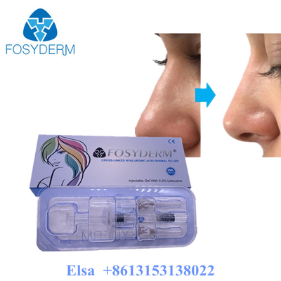 Fosyderm Deep 2ml Dermale Filler voor gezichtsverjonging HA Filler