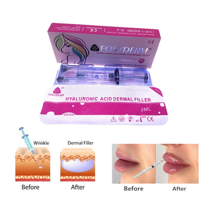 Fosyderm 2 ml Hyaluronzuur Gel Dermale vulmiddel injecties voor gezichts- en neushuidverzorging