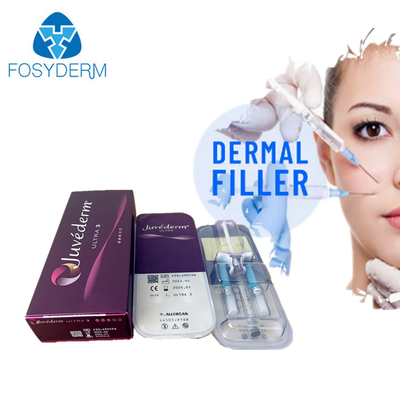 Juvederm Ultra3 Injecteerbare huidvuller Hyaluronzuur injectie voor het gezicht