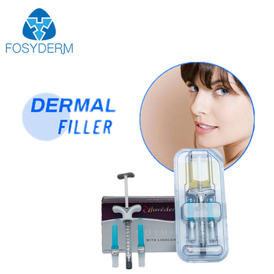 Juvederm Voluma Hyaluronzuur Gezichtslip Filler