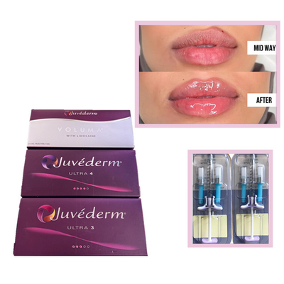 Juvederm Voluma Ultra3 Ultra4 HA Gelvullers 2 ml hyaluronzuur