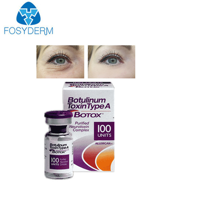Botulinum Toxin anti-rimpel injectie Gefermenteerd Stabiel Eiwit in Neutraal