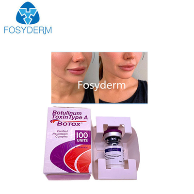 Type A 100 Eenheden Allergan Botulinum Toxin Dermale vulmiddel Hyaluronzuur