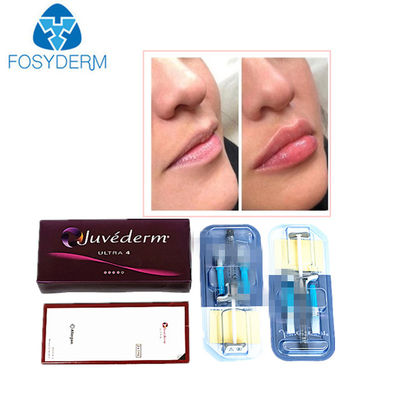Juvederm Hyaluronzuur Dermaal Filler Anti Wrinkles Injectie Voor Gezicht