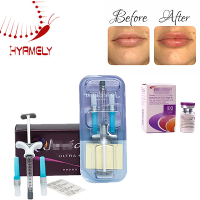 Allergan Injection Botulinum Toxin Anti Wrinkle Dermal Filler voor gezicht en nek