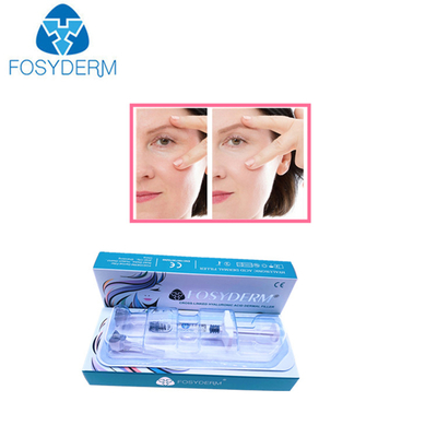 Hyaluronzuur huidvuller voor gezichtsverjonging 1 ml-50 ml