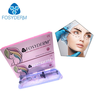 Hyaluronzuur Dermal Filler 24mg/ml voor Gezicht, Lippen, Wangen, Kin