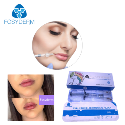 Hyaluronzuur Dermal Filler 24mg/ml voor Gezicht, Lippen, Wangen, Kin