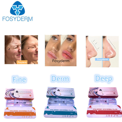 Hyaluronzuur Dermal Filler 1ml-50ml voor Gezicht en Lichaam